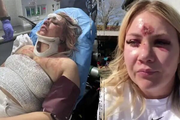 Bride-to-be left with broken nose, teeth after brutal bachelorette attack: police